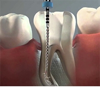 Endodonzia Clinica